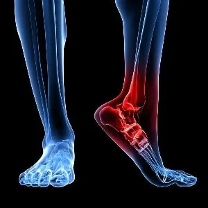 https://phantomphysio.ir/UserFiles/%d8%a2%d9%85%d9%88%d8%b2%d8%b4/%d8%aa%d8%b1%d8%af%d9%85%db%8c%d9%84%20%d9%88%20%d8%af%d8%b1%d9%85%d8%a7%d9%86%20%d9%85%d8%b4%da%a9%d9%84%d8%a7%d8%aa%20%d9%85%da%86%20%d9%be%d8%a7%202-min.webp